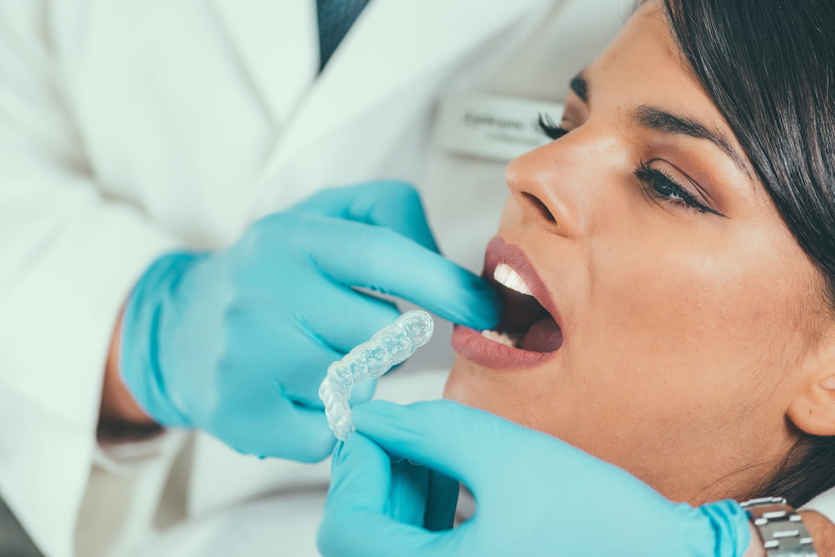 bruxismo-denti