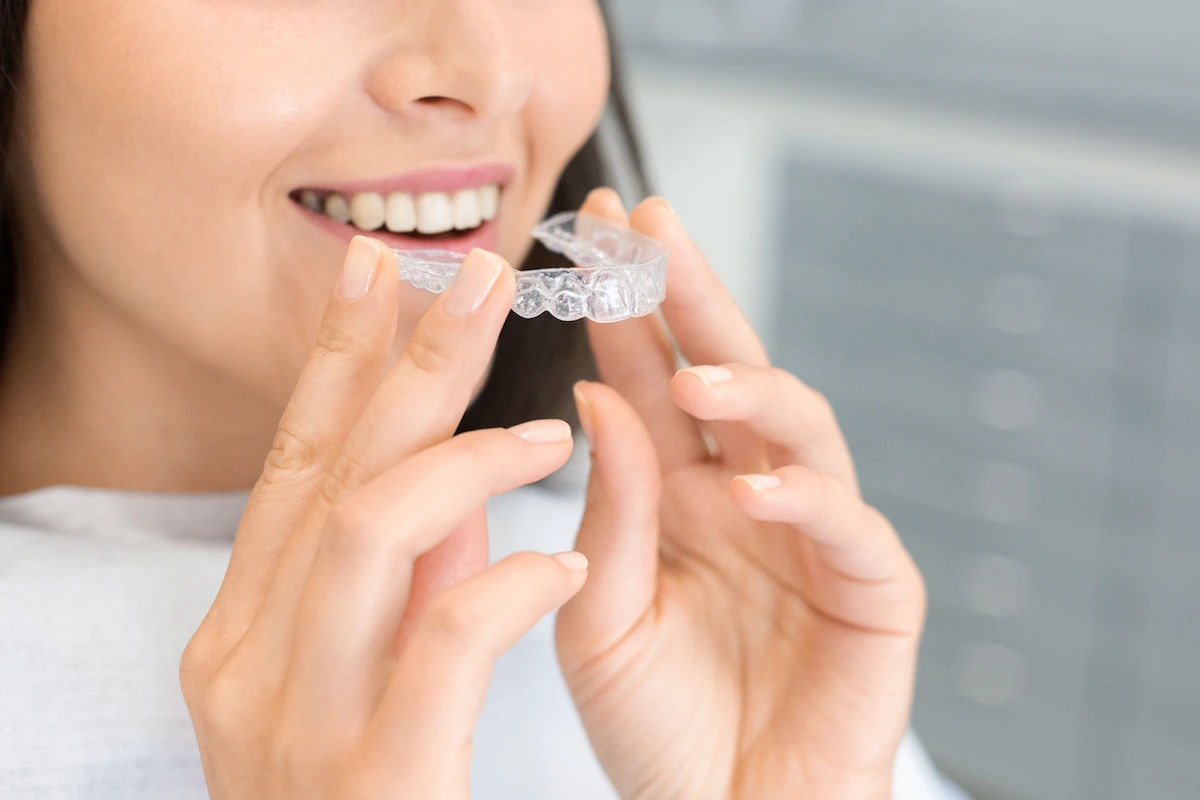 come-vengono-realizzate-le-mascherine-Invisalign