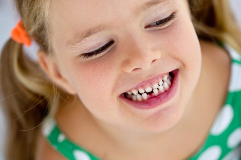 Denti Che Non Spuntano Qual La Causa E Cosa Fare Dentista Bambini 