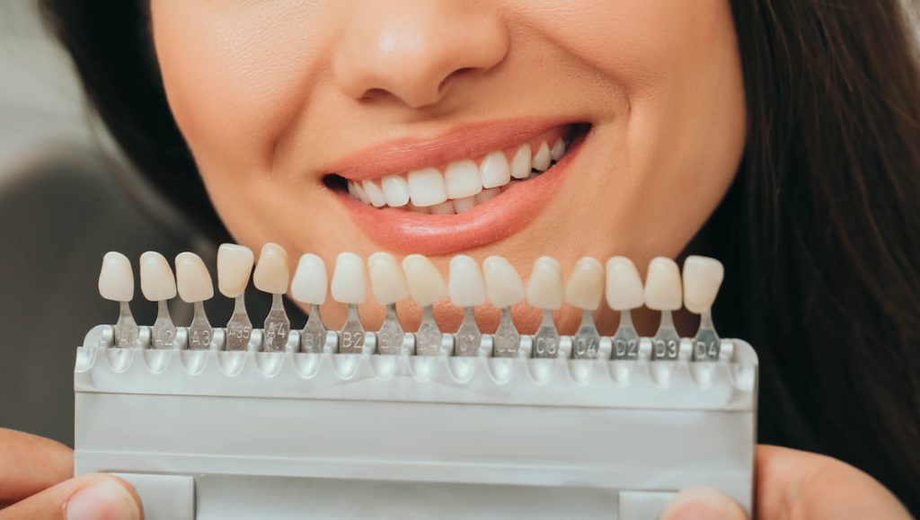 corona-del-dente