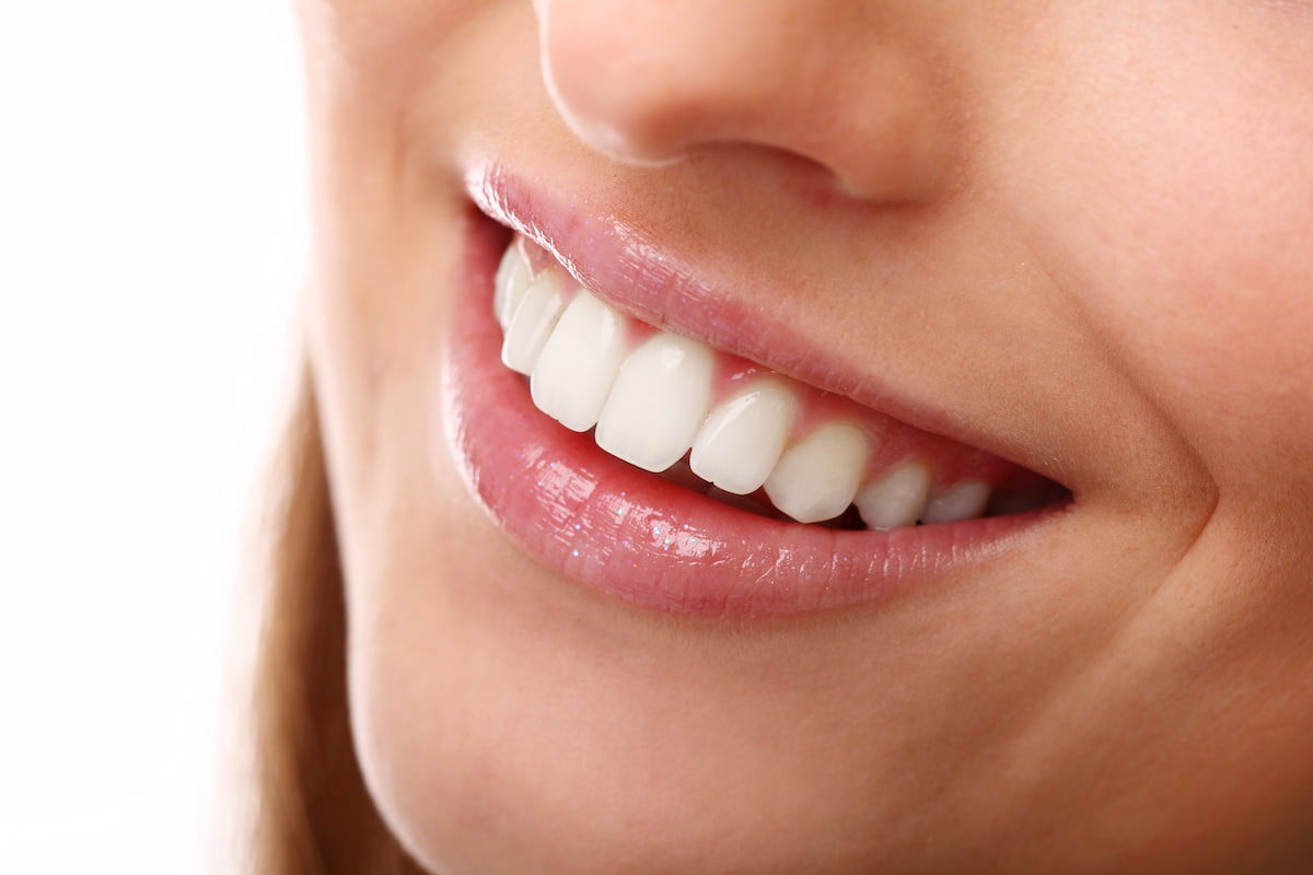 smilemakeover
