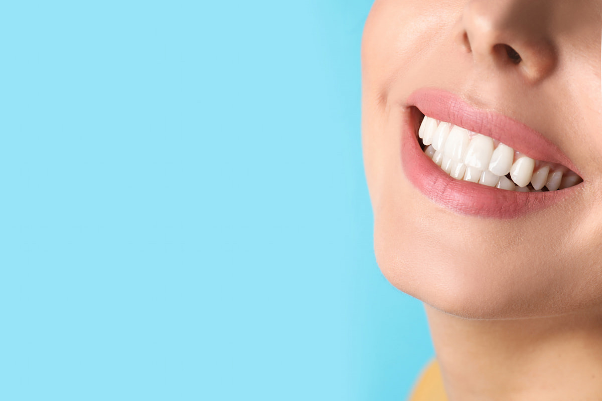 pulizia-impianti-dentali-fissi