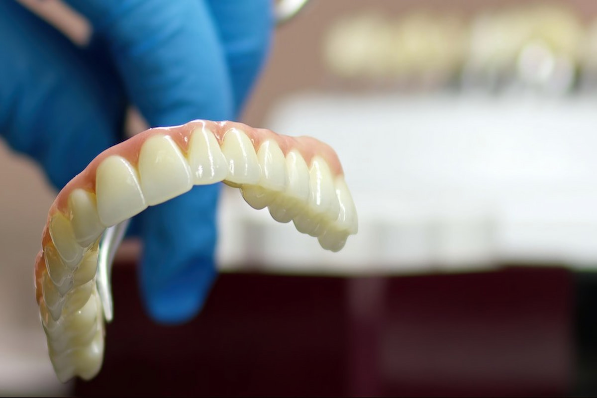 denti-mobili