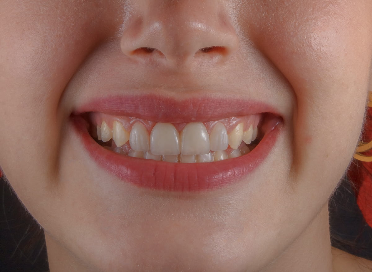 denti-e-postura