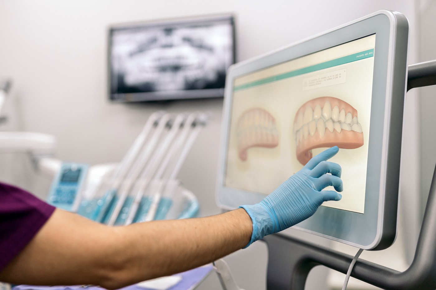 implantologia guidata studio fadda dentistico